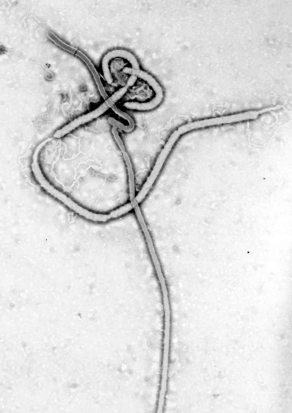 The Ebola Vaccine Proves Itself
